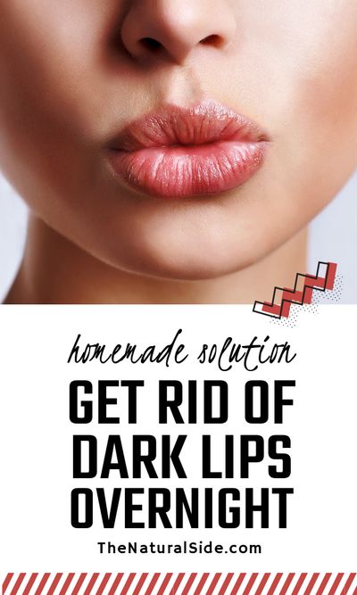 Exfoliate your dark lips and then use these home remedies to get rid of dark lips fast. DIY beauty via thenaturalside.com #beauty #skincare #lips