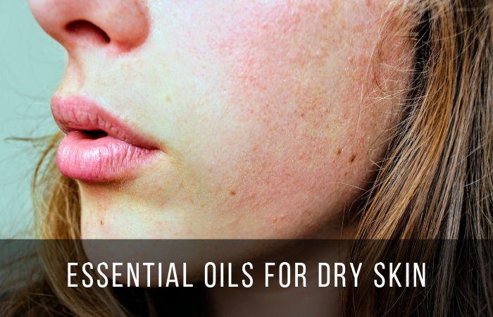 Do you have dry skin that feels rough and cracked? Find the best essential oils for dry skin that will help you get back that natural skin glow.